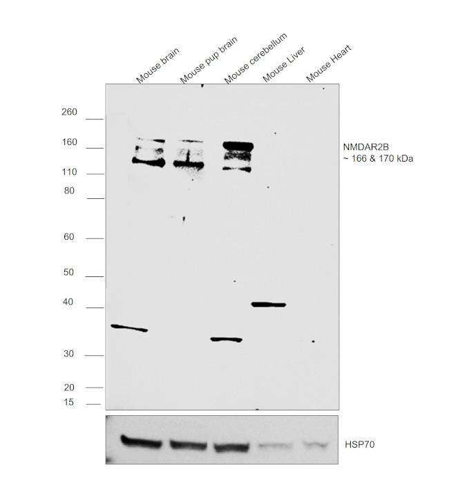 NMDAR2B Antibody in Western Blot (WB)