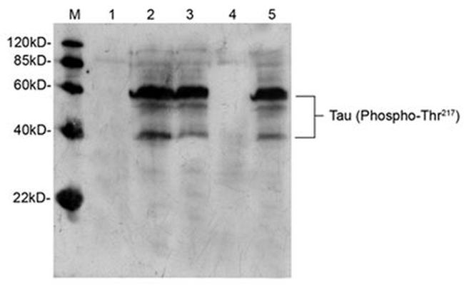 Phospho-Tau (Thr217) Antibody in Western Blot (WB)