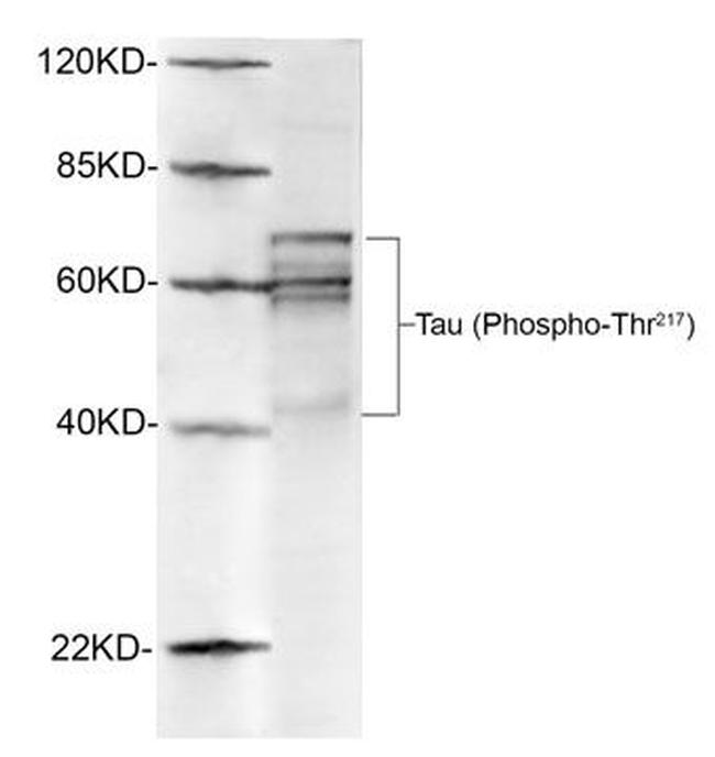 Phospho-Tau (Thr217) Antibody in Western Blot (WB)