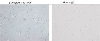 beta-Amyloid 1-42 Antibody in Immunohistochemistry (Paraffin) (IHC (P))