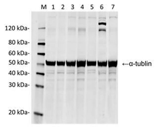 SpCas9 Antibody in Western Blot (WB)