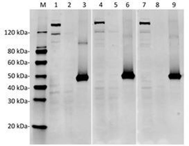 SpCas9 Antibody in Western Blot (WB)