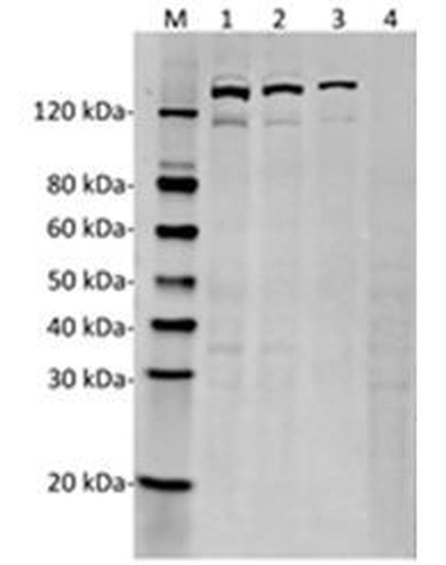 SpCas9 Antibody in Western Blot (WB)