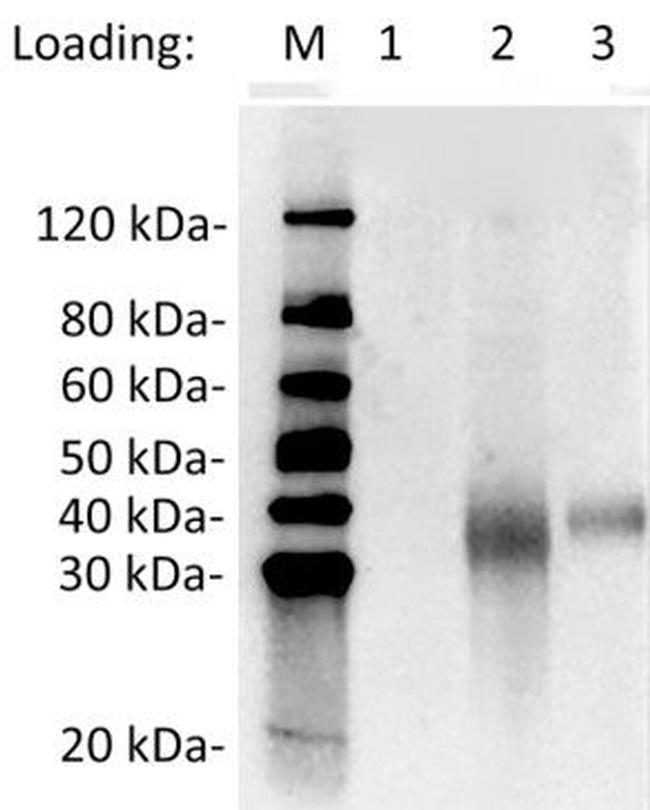 SARS-CoV-2 Neutralizing Antibody in Western Blot (WB)