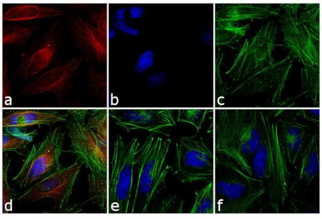 Mouse IgG (H+L) Highly Cross-Adsorbed Secondary Antibody in Immunocytochemistry (ICC/IF)