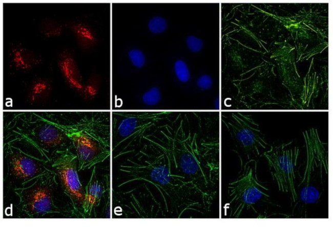 Rabbit IgG (H+L) Highly Cross-Adsorbed Secondary Antibody in Immunocytochemistry (ICC/IF)