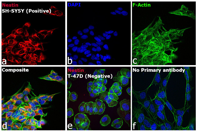 Mouse IgG (H+L) Cross-Adsorbed Secondary Antibody in Immunocytochemistry (ICC/IF)