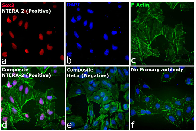 Rat IgG (H+L) Cross-Adsorbed Secondary Antibody in Immunocytochemistry (ICC/IF)