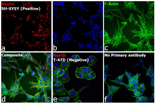 Mouse IgG (H+L) Cross-Adsorbed Secondary Antibody in Immunocytochemistry (ICC/IF)