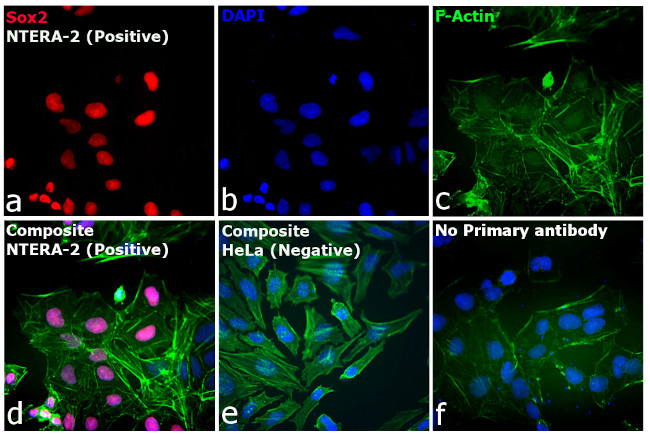 Rat IgG (H+L) Cross-Adsorbed Secondary Antibody in Immunocytochemistry (ICC/IF)