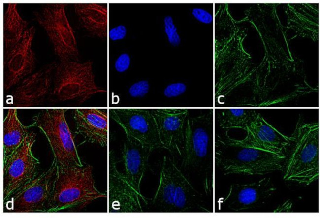 Rat IgG (H+L) Cross-Adsorbed Secondary Antibody in Immunocytochemistry (ICC/IF)