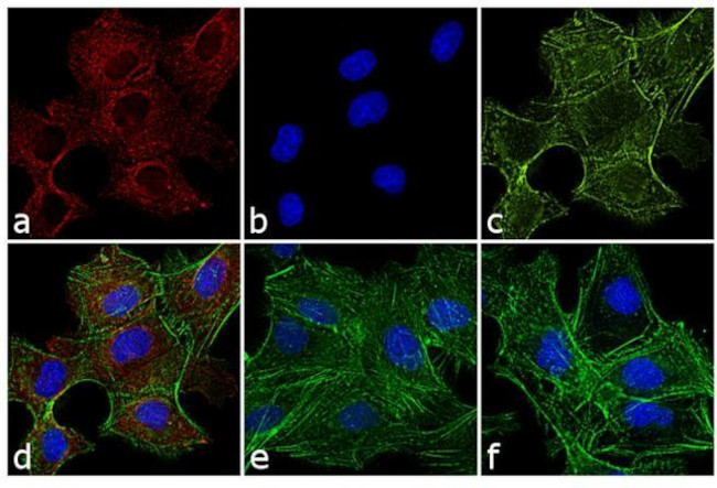 Rat IgG (H+L) Cross-Adsorbed Secondary Antibody in Immunocytochemistry (ICC/IF)