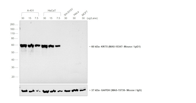 Mouse IgG1 Cross-Adsorbed Secondary Antibody in Western Blot (WB)