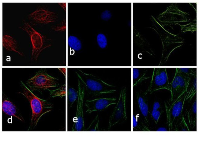 Rabbit IgG (H+L) Cross-Adsorbed Secondary Antibody in Immunocytochemistry (ICC/IF)