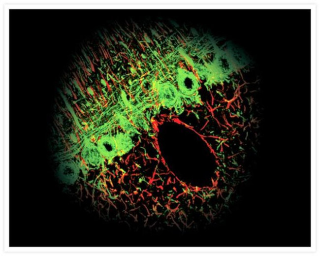 Mouse IgG (H+L) Cross-Adsorbed Secondary Antibody in Immunocytochemistry (ICC/IF)