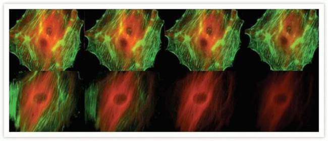 Mouse IgG (H+L) Cross-Adsorbed Secondary Antibody in Immunocytochemistry (ICC/IF)