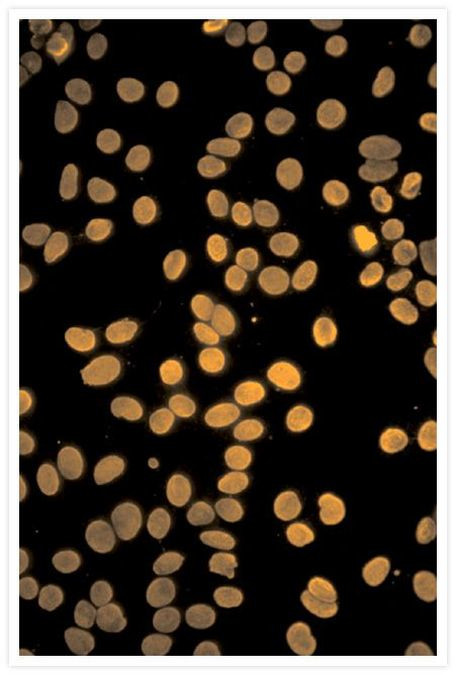 Mouse IgG (H+L) Cross-Adsorbed Secondary Antibody in Immunocytochemistry (ICC/IF)