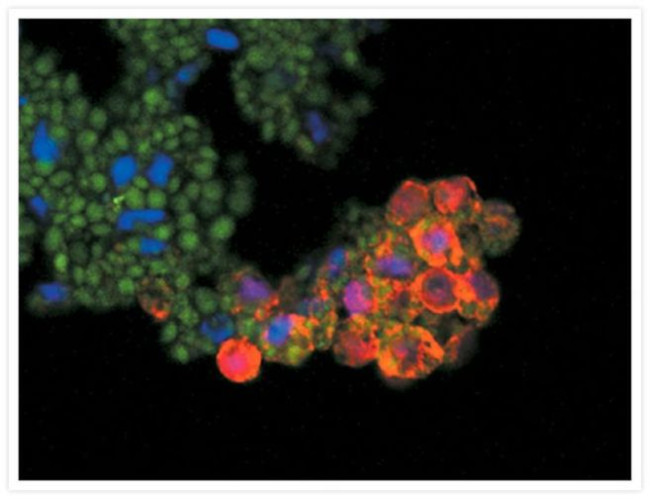 Mouse IgG (H+L) Cross-Adsorbed Secondary Antibody in Immunocytochemistry (ICC/IF)