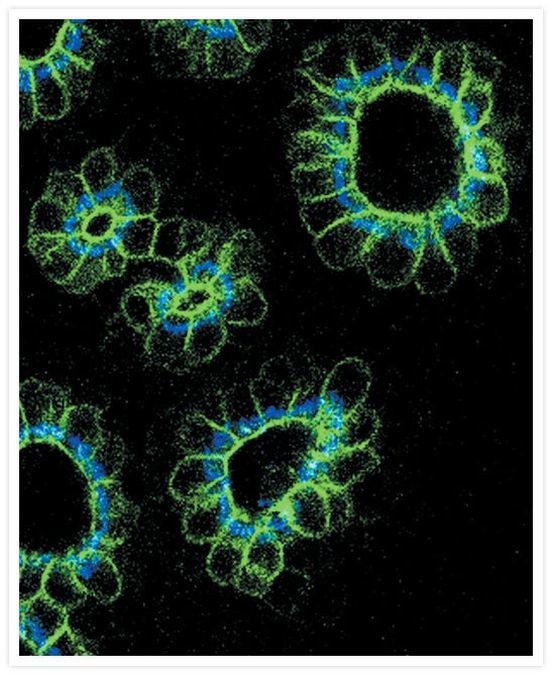 Mouse IgG (H+L) Cross-Adsorbed Secondary Antibody in Immunohistochemistry (IHC)