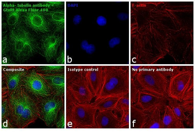 Rat IgG (H+L) Cross-Adsorbed Secondary Antibody in Immunocytochemistry (ICC/IF)