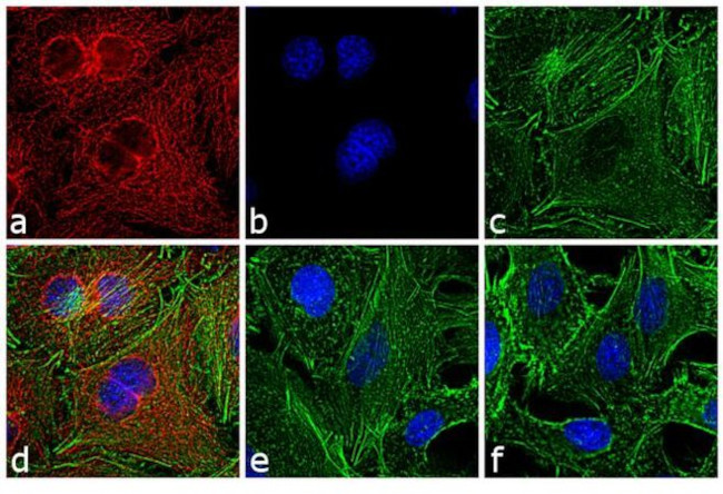 Rat IgG (H+L) Cross-Adsorbed Secondary Antibody in Immunocytochemistry (ICC/IF)