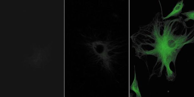 Rabbit IgG (H+L) Cross-Adsorbed Secondary Antibody in Immunocytochemistry (ICC/IF)