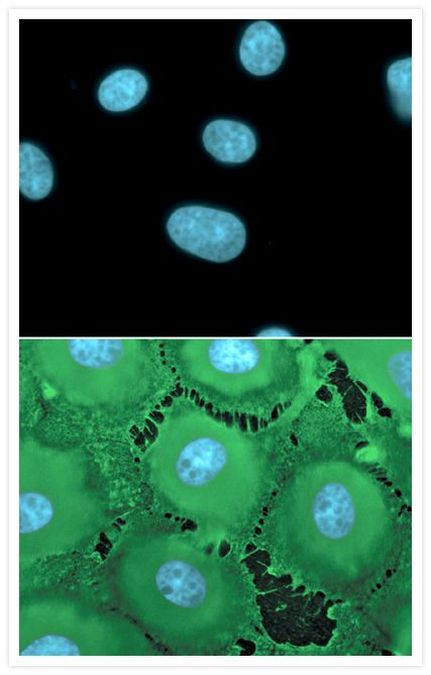 Rabbit IgG (H+L) Cross-Adsorbed Secondary Antibody in Immunocytochemistry (ICC/IF)