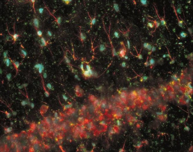 Rabbit IgG (H+L) Cross-Adsorbed Secondary Antibody in Immunohistochemistry (Frozen) (IHC (F))