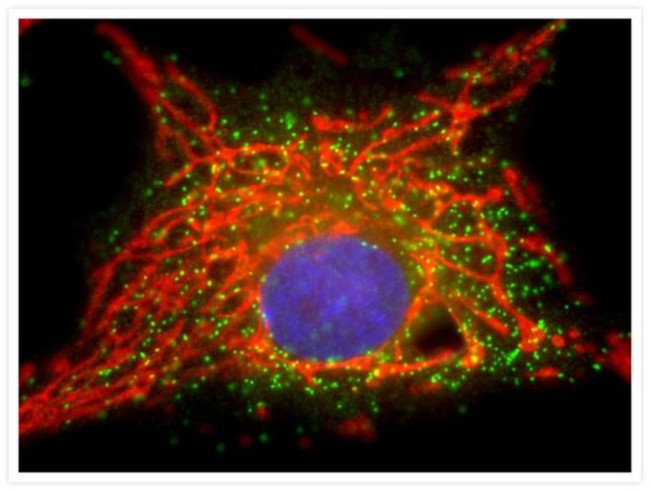 Rabbit IgG (H+L) Cross-Adsorbed Secondary Antibody in Immunocytochemistry (ICC/IF)