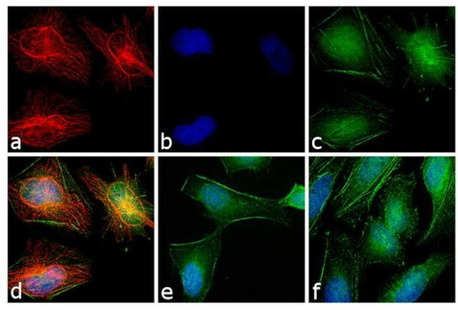 Rabbit IgG (H+L) Cross-Adsorbed Secondary Antibody in Immunocytochemistry (ICC/IF)