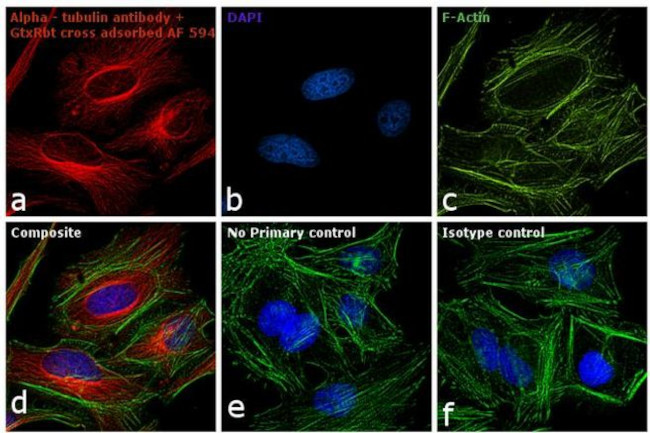 Rabbit IgG (H+L) Cross-Adsorbed Secondary Antibody in Immunocytochemistry (ICC/IF)