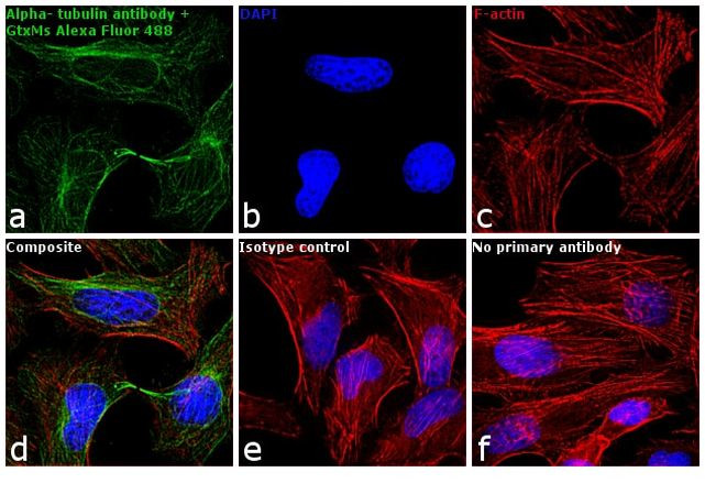 Mouse IgG (H+L) Cross-Adsorbed Secondary Antibody in Immunocytochemistry (ICC/IF)