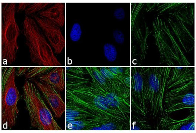 Mouse IgG (H+L) Cross-Adsorbed Secondary Antibody in Immunocytochemistry (ICC/IF)