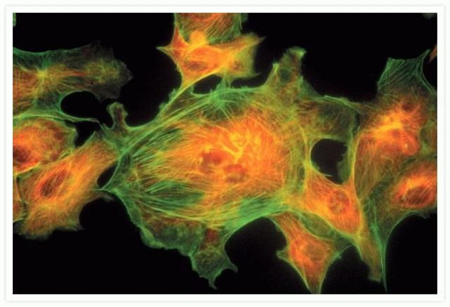 Mouse IgG (H+L) Cross-Adsorbed Secondary Antibody in Immunocytochemistry (ICC/IF)