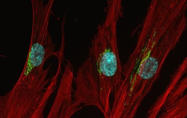 Mouse IgG (H+L) Highly Cross-Adsorbed Secondary Antibody in Immunocytochemistry (ICC/IF)