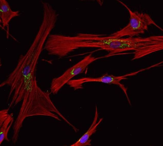 Mouse IgG (H+L) Highly Cross-Adsorbed Secondary Antibody in Immunocytochemistry (ICC/IF)