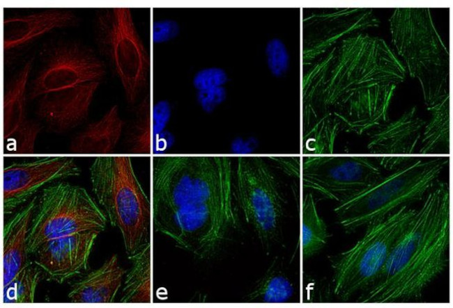 Mouse IgG (H+L) Highly Cross-Adsorbed Secondary Antibody in Immunocytochemistry (ICC/IF)