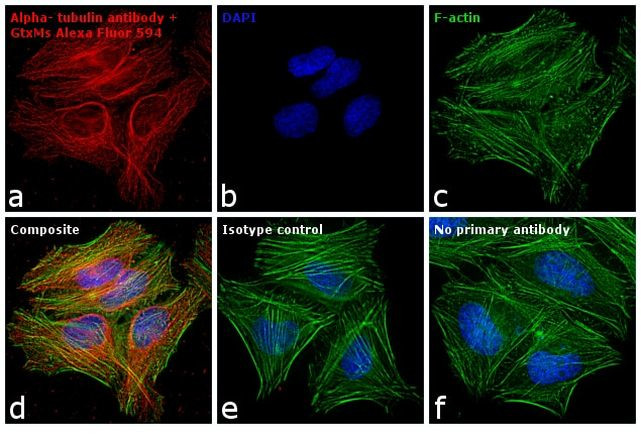 Mouse IgG (H+L) Highly Cross-Adsorbed Secondary Antibody in Immunocytochemistry (ICC/IF)