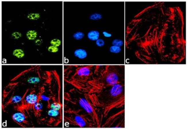 Mouse IgG (H+L) Highly Cross-Adsorbed Secondary Antibody in Immunocytochemistry (ICC/IF)