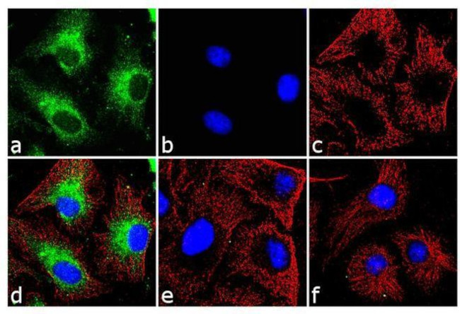 Mouse IgG (H+L) Highly Cross-Adsorbed Secondary Antibody in Immunocytochemistry (ICC/IF)