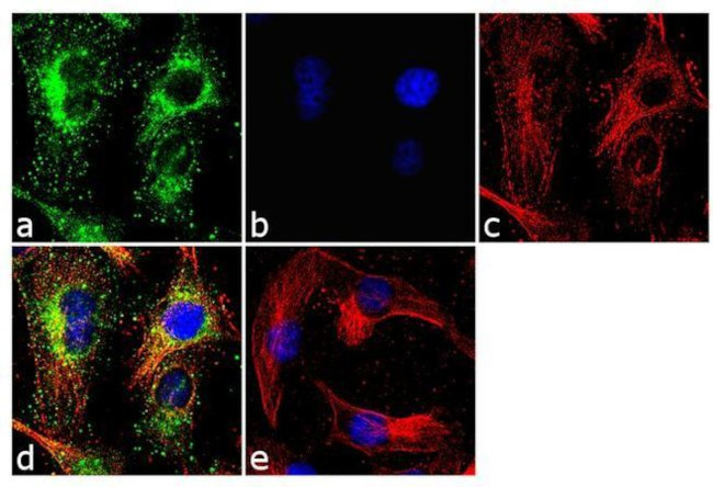 Mouse IgG (H+L) Highly Cross-Adsorbed Secondary Antibody in Immunocytochemistry (ICC/IF)