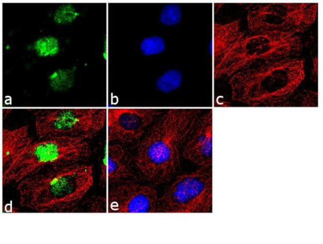 Mouse IgG (H+L) Highly Cross-Adsorbed Secondary Antibody in Immunocytochemistry (ICC/IF)