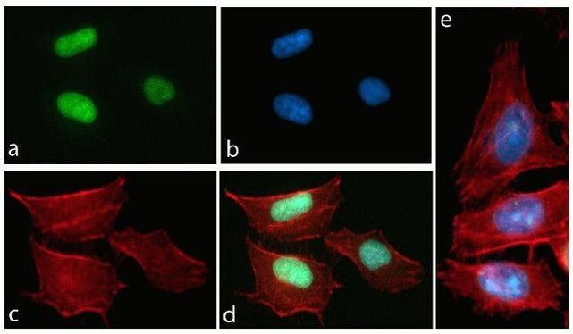 Rabbit IgG (H+L) Highly Cross-Adsorbed Secondary Antibody in Immunocytochemistry (ICC/IF)