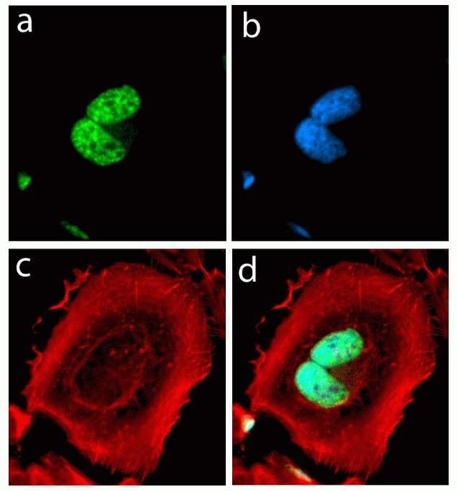 Rabbit IgG (H+L) Highly Cross-Adsorbed Secondary Antibody in Immunocytochemistry (ICC/IF)