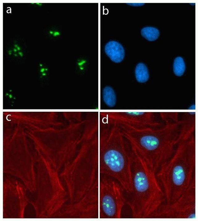 Rabbit IgG (H+L) Highly Cross-Adsorbed Secondary Antibody in Immunocytochemistry (ICC/IF)