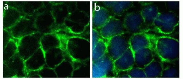 Rabbit IgG (H+L) Highly Cross-Adsorbed Secondary Antibody in Immunocytochemistry (ICC/IF)