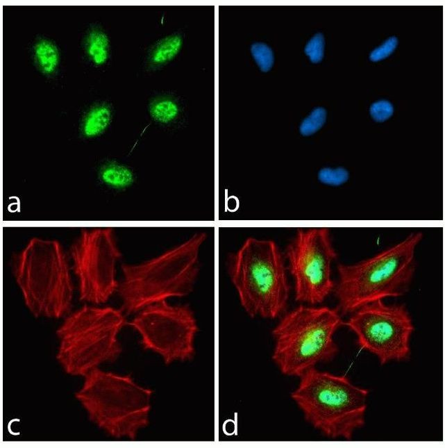 Rabbit IgG (H+L) Highly Cross-Adsorbed Secondary Antibody in Immunocytochemistry (ICC/IF)