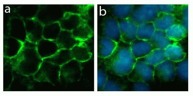 Rabbit IgG (H+L) Highly Cross-Adsorbed Secondary Antibody in Immunocytochemistry (ICC/IF)