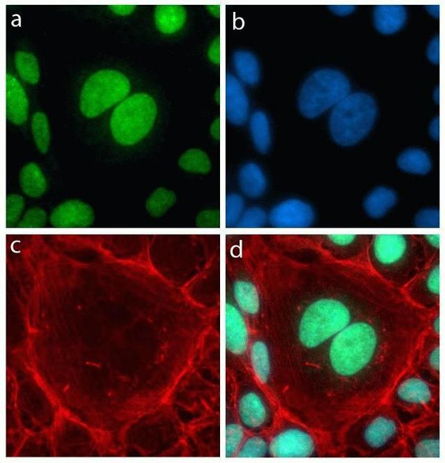 Rabbit IgG (H+L) Highly Cross-Adsorbed Secondary Antibody in Immunocytochemistry (ICC/IF)