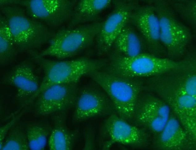 Rabbit IgG (H+L) Highly Cross-Adsorbed Secondary Antibody in Immunocytochemistry (ICC/IF)